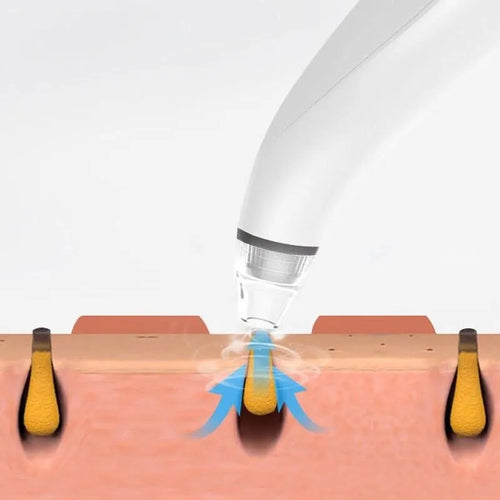 Diamond Pore Vacuum - Electric Blackhead Remover for Face