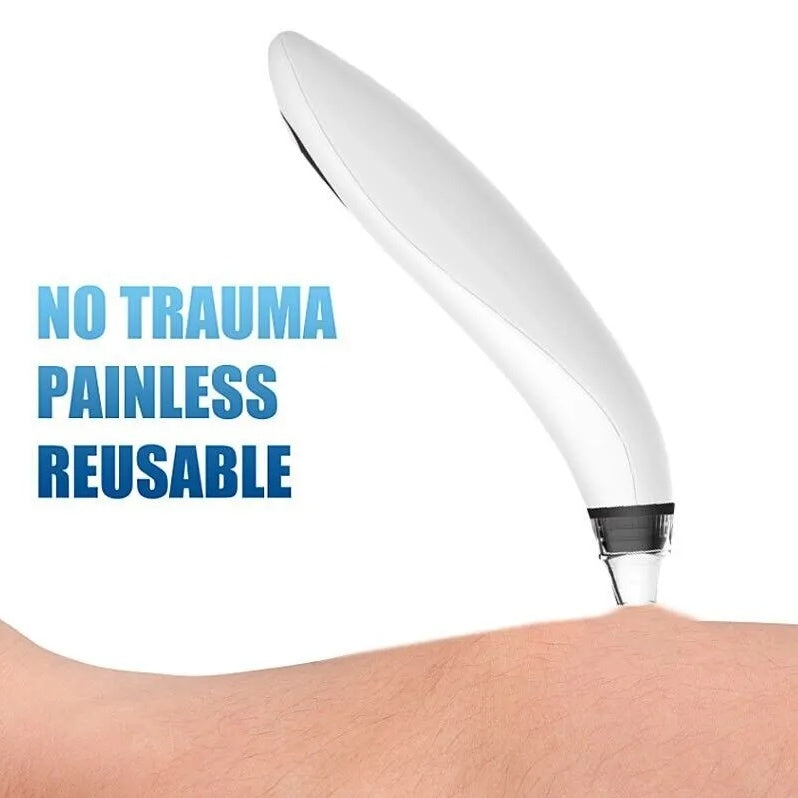 Diamond Pore Vacuum - Electric Blackhead Remover for Face